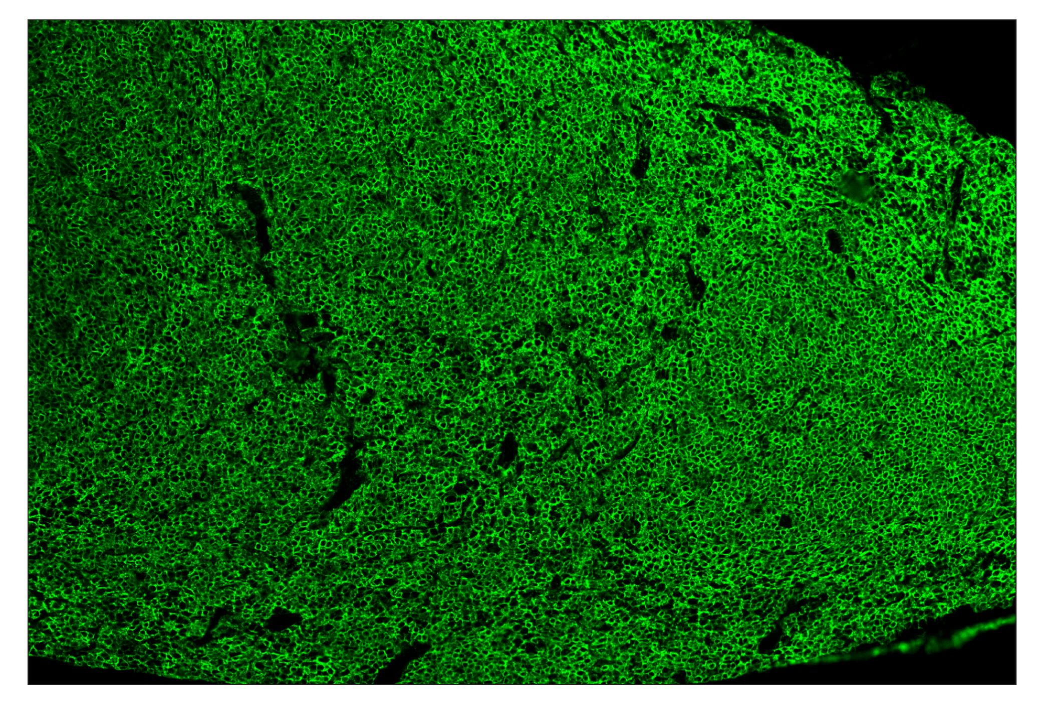 Immunohistochemistry Image 2: CD45 (D3F8Q) & CO-0046-488 SignalStar™ Oligo-Antibody Pair