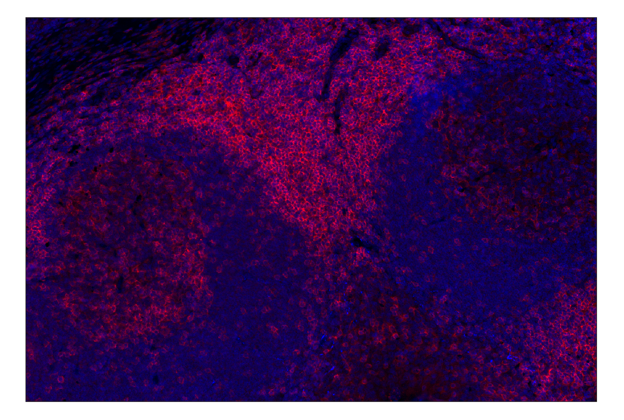 Immunohistochemistry Image 1: CD4 (MSVA-004R) Rabbit mAb (Alexa Fluor® 647 Conjugate)
