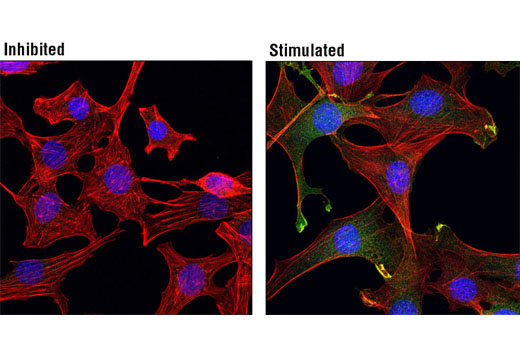 Immunofluorescence Image 1: Phospho-Akt (Ser473) (193H12) Rabbit mAb