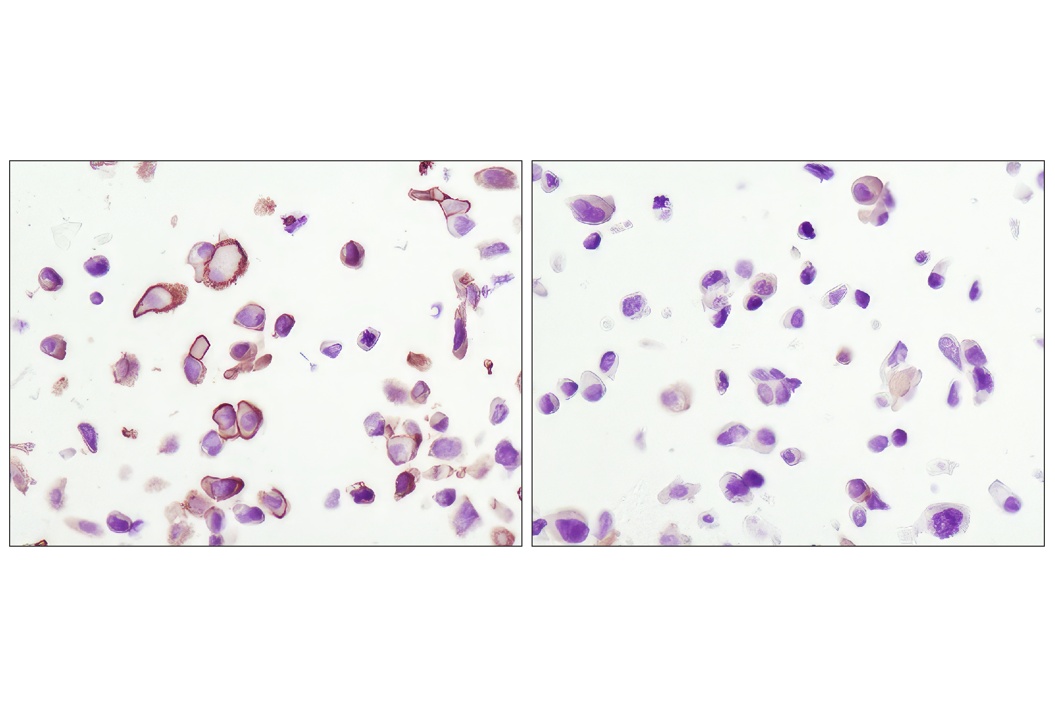  Image 25: AS160 Signaling Antibody Sampler Kit