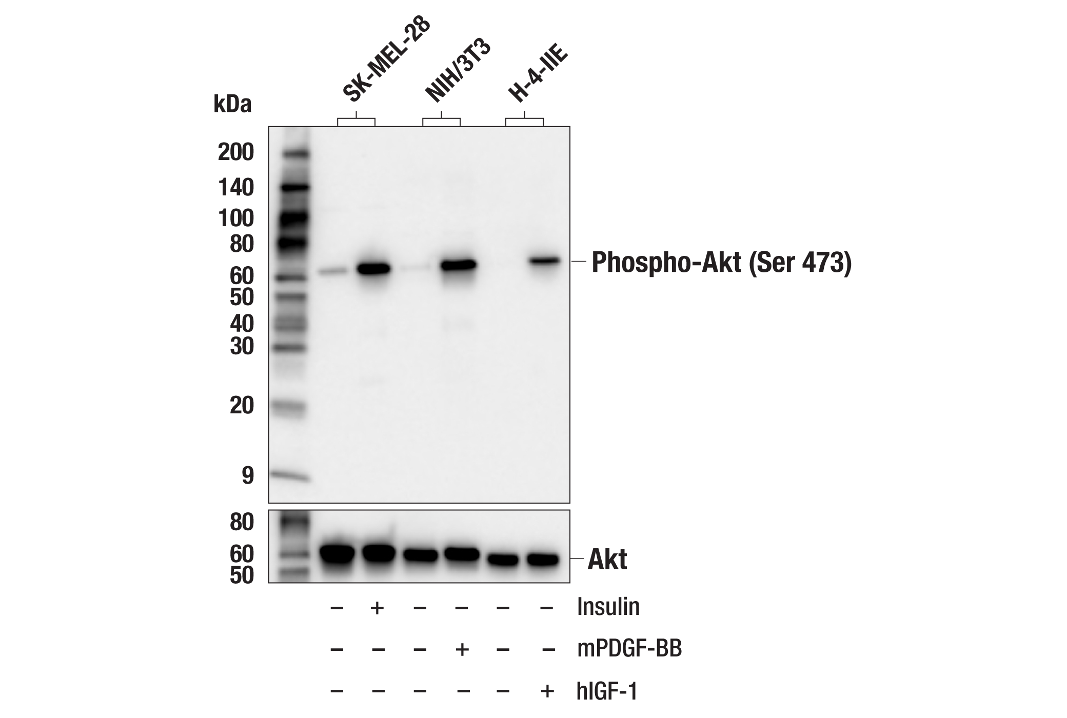 Western Blotting Image 1: Phospho-Akt (Ser473) (D9E) XP® Rabbit mAb