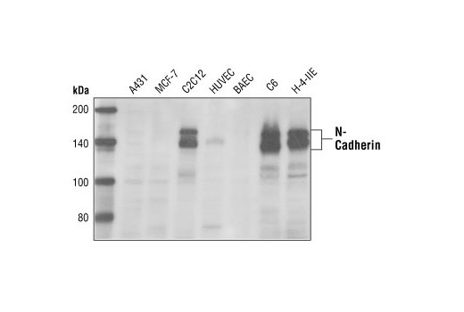 Western Blotting Image 1: N-Cadherin Antibody