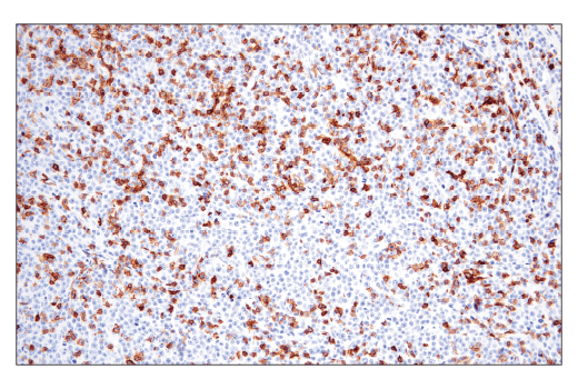 Immunohistochemistry Image 5: CD6 (E9Y7Y) Rabbit mAb