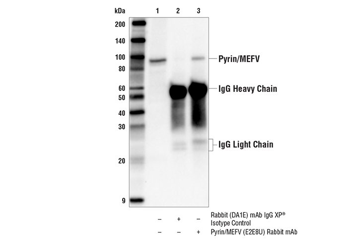 Immunoprecipitation Image 1: Pyrin/MEFV (E2E8U) Rabbit mAb