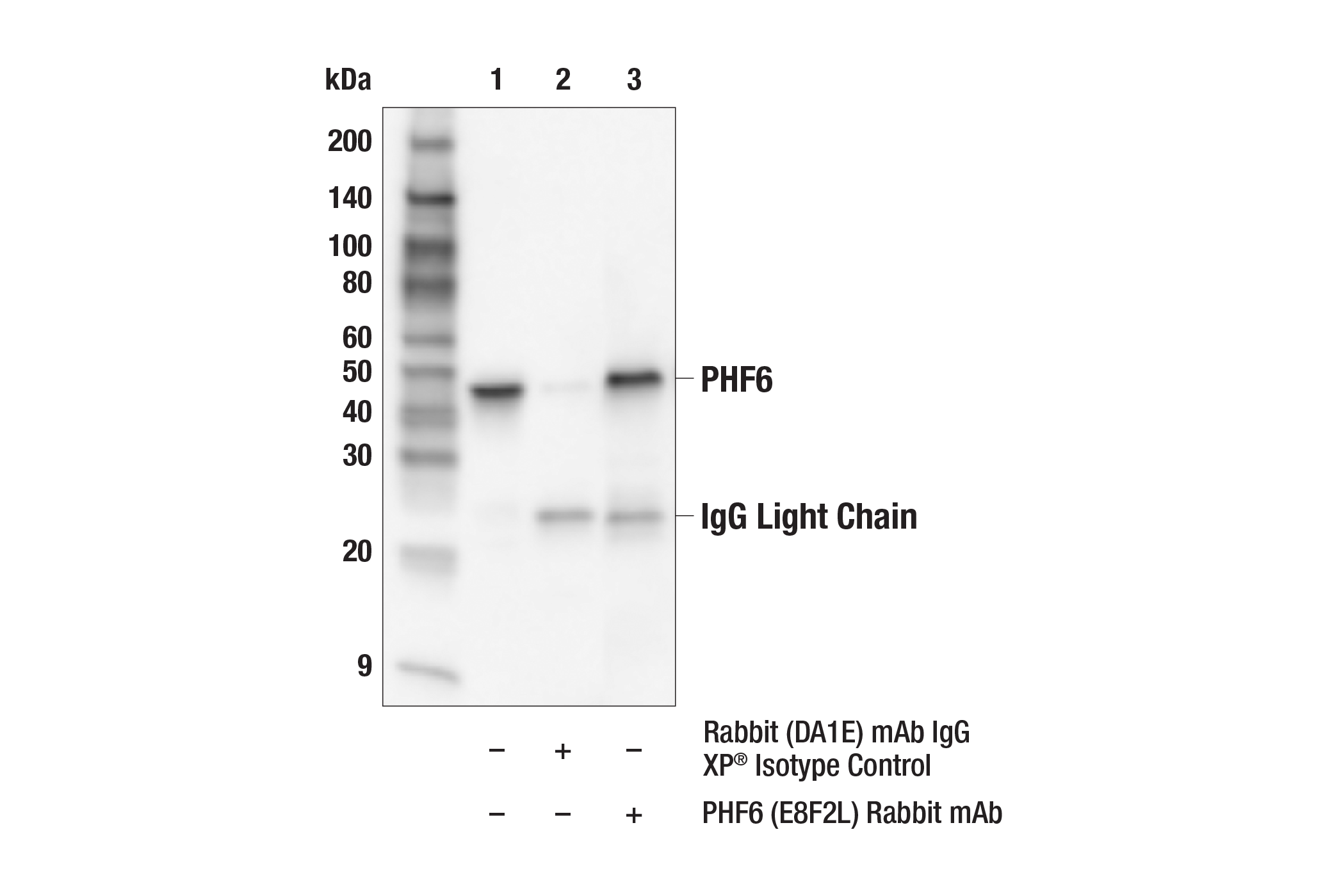 Immunoprecipitation Image 1: PHF6 (E8F2L) Rabbit mAb