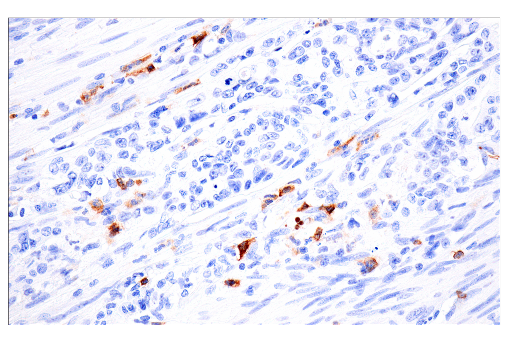 Immunohistochemistry Image 15: CD177 (F9O5U) Rabbit mAb (BSA and Azide Free)