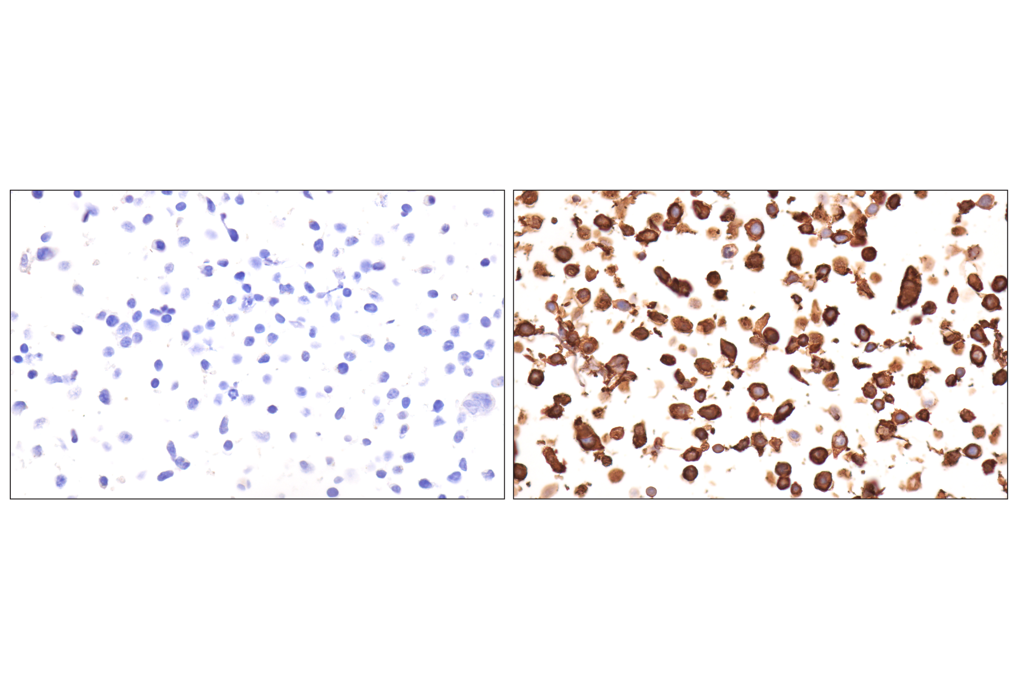 Immunohistochemistry Image 19: CD177 (F9O5U) Rabbit mAb (BSA and Azide Free)