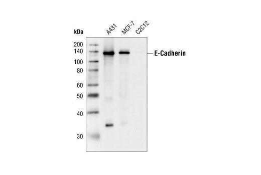 Western Blotting Image 1: E-Cadherin Antibody
