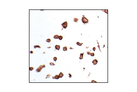 Immunohistochemistry Image 1: E-Cadherin Antibody