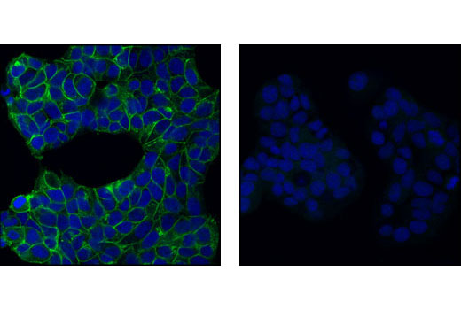 Immunofluorescence Image 1: E-Cadherin Antibody