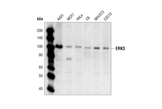 Western Blotting Image 1: Erk3 Antibody