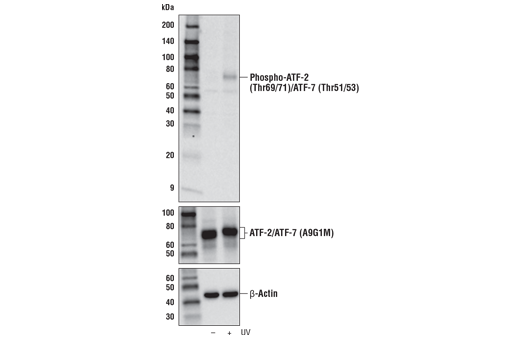 Western Blotting Image 1: Phospho-ATF-2 (Thr69/71)/ATF-7 (Thr51/53) Antibody