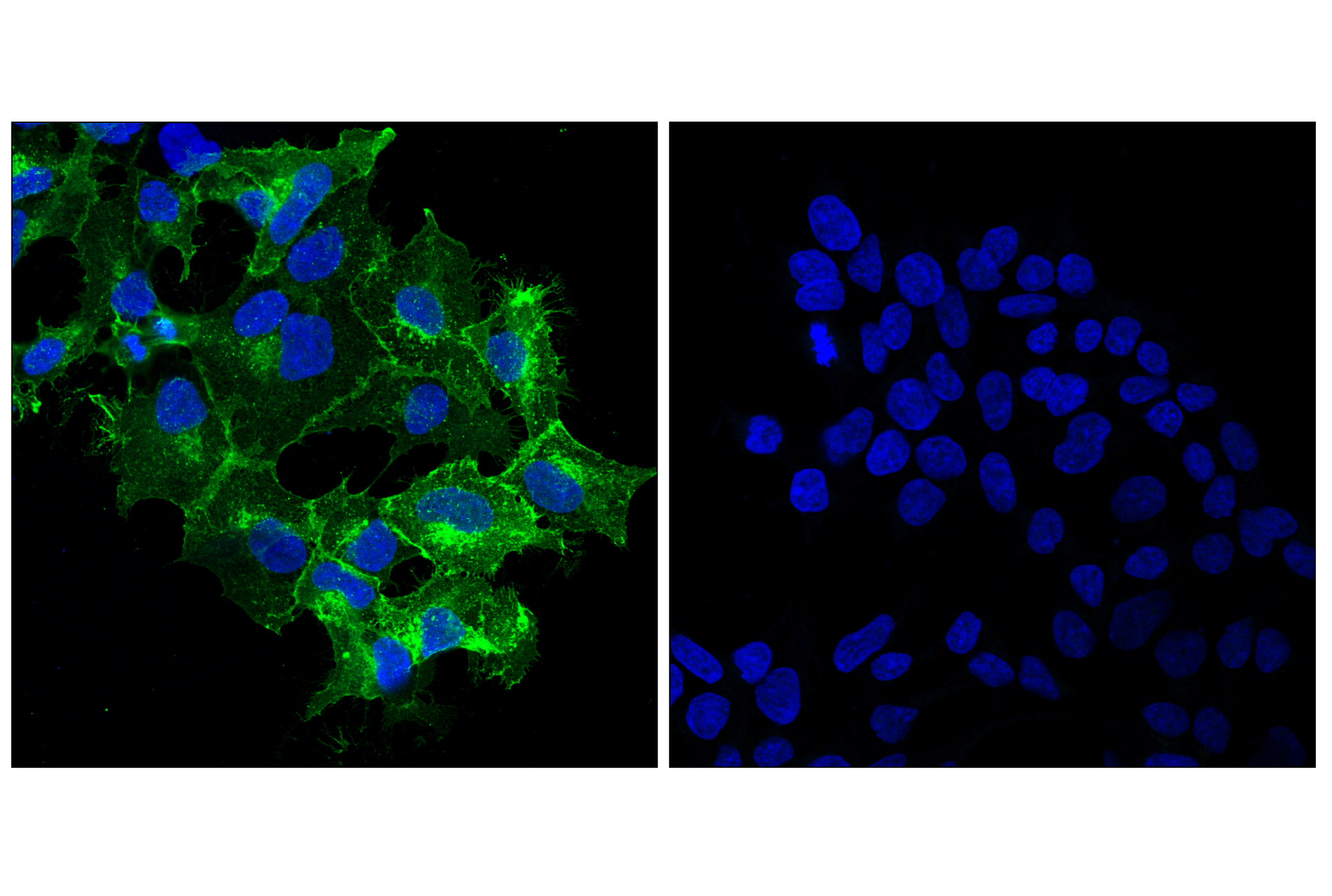Immunofluorescence Image 1: Myc-Tag (71D10) Rabbit mAb (Alexa Fluor® 488 Conjugate)