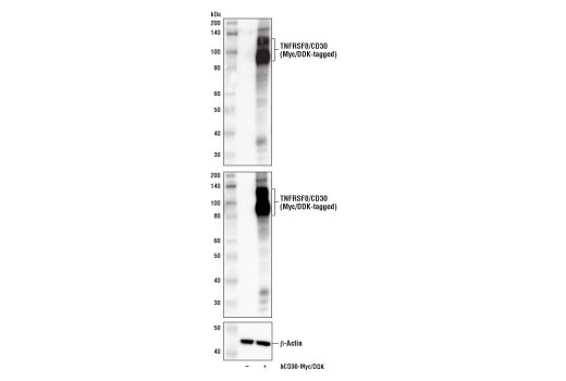 Western Blotting Image 1: TNFRSF8/CD30 Antibody