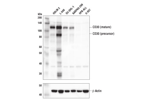 Western Blotting Image 2: TNFRSF8/CD30 Antibody