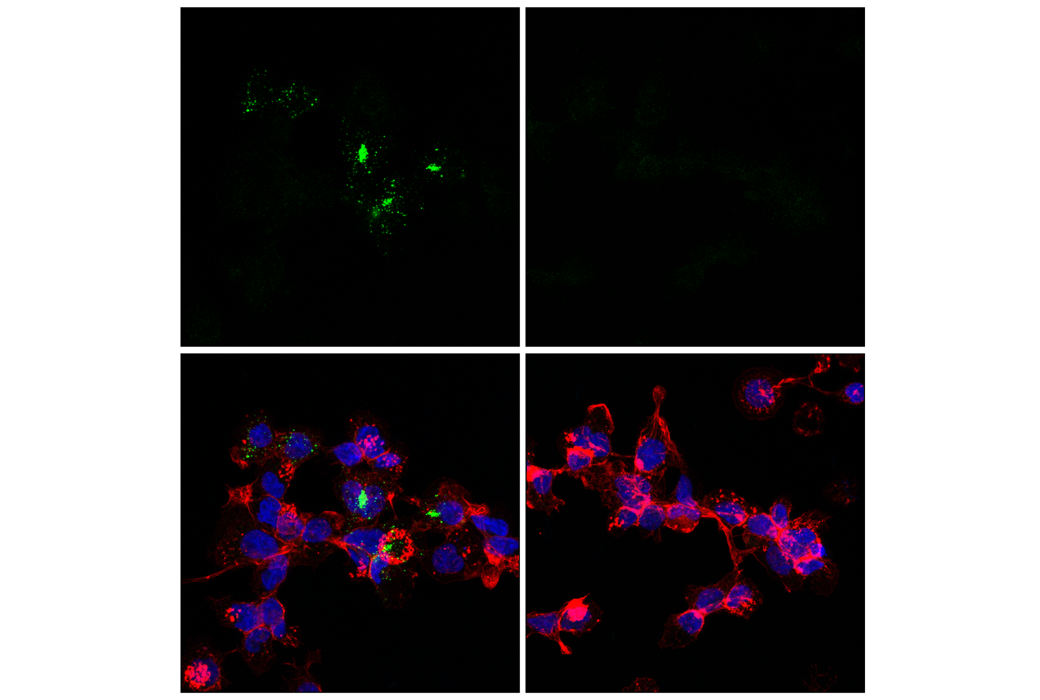 Immunofluorescence Image 1: Phospho-STING (Ser366) (D8K6H) Rabbit mAb