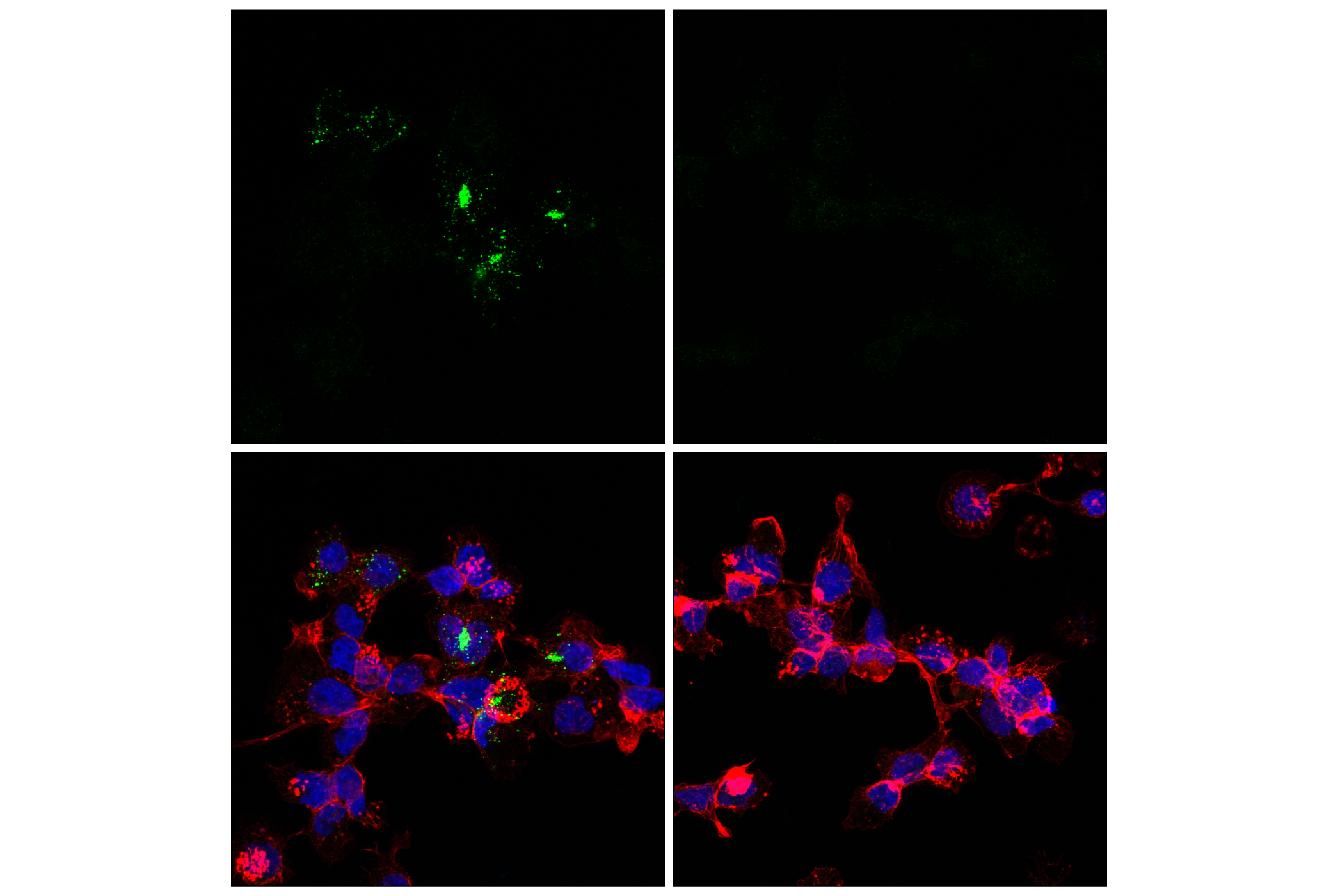 Phospho-STING (Ser366) (D8K6H) Rabbit mAb | Cell Signaling Technology