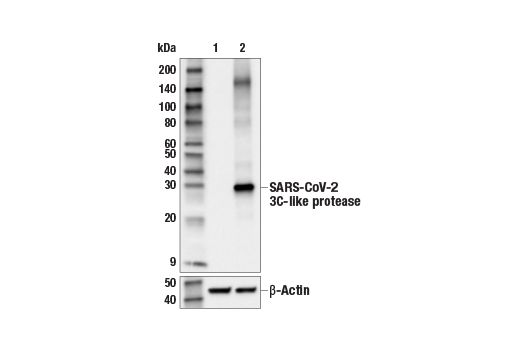 Western Blotting Image 1: SARS-CoV-2 3C-Like Protease (E4D3W) Rabbit mAb