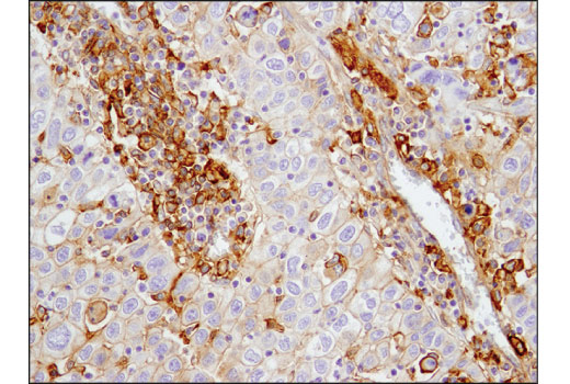 Immunohistochemistry Image 2: CD40 (D8W3N) Rabbit mAb