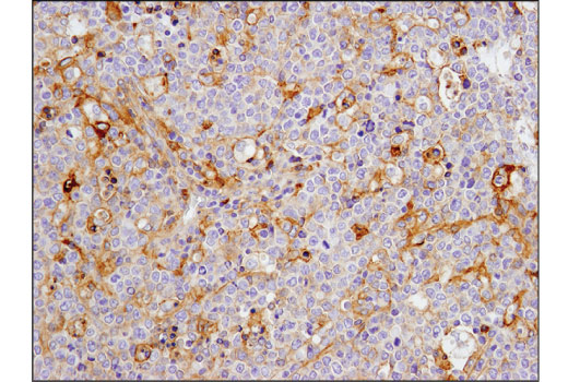 Immunohistochemistry Image 3: CD40 (D8W3N) Rabbit mAb