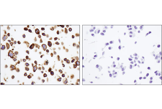 Immunohistochemistry Image 4: CD40 (D8W3N) Rabbit mAb