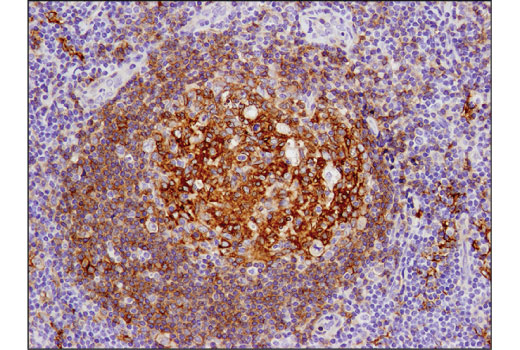 Immunohistochemistry Image 5: CD40 (D8W3N) Rabbit mAb