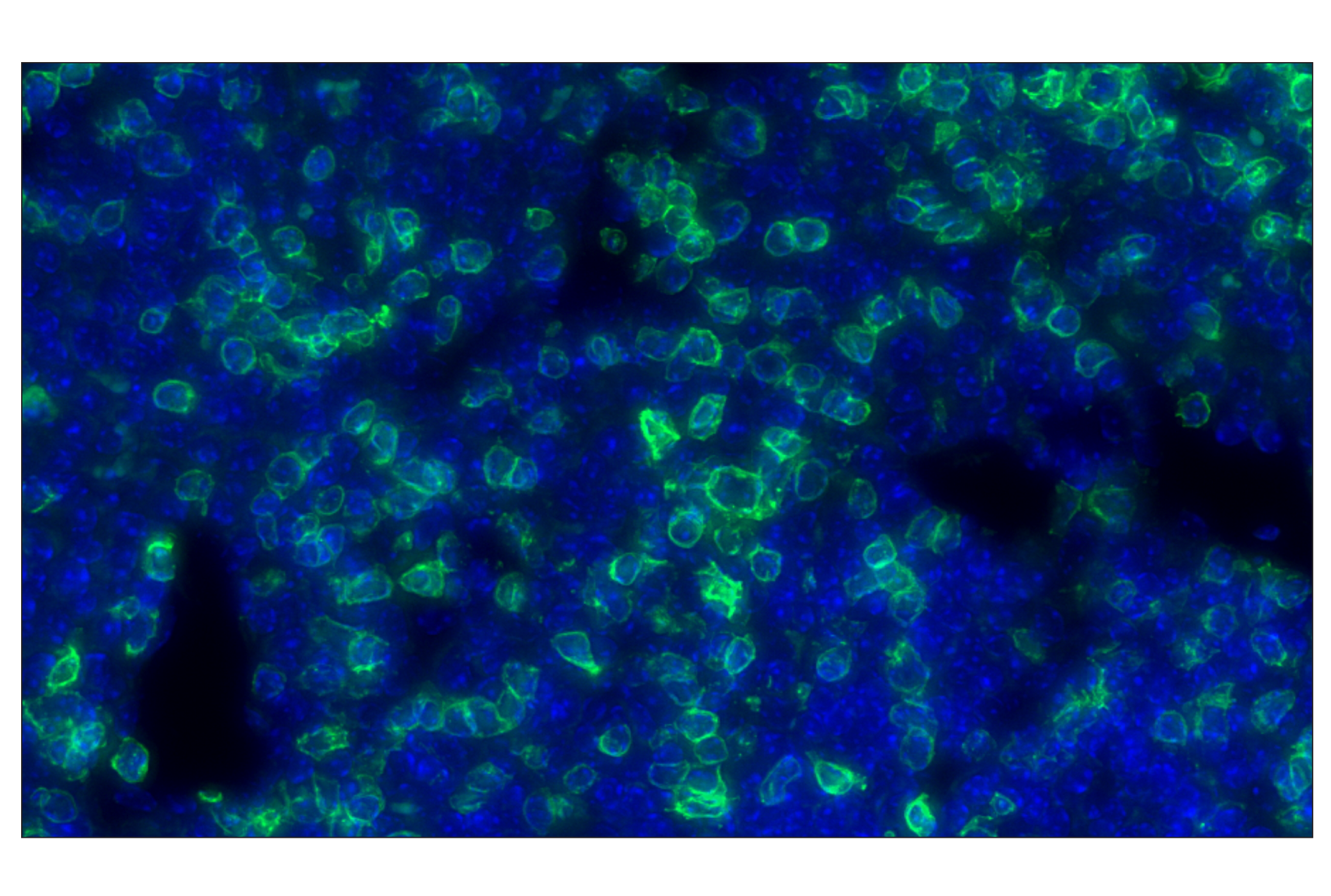 Immunohistochemistry Image 1: CD3ε (E4T1B) XP® Rabbit mAb (Alexa Fluor® 488 Conjugate)