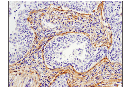 Immunohistochemistry Image 3: MMP-2 (D4M2N) Rabbit mAb