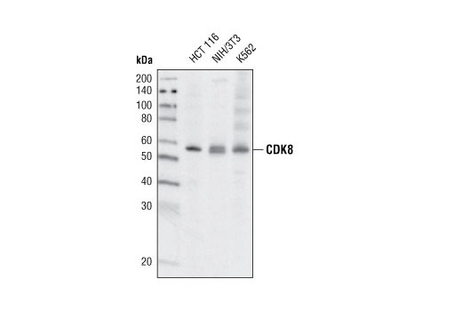 Western Blotting Image 1: CDK8 (G398) Antibody