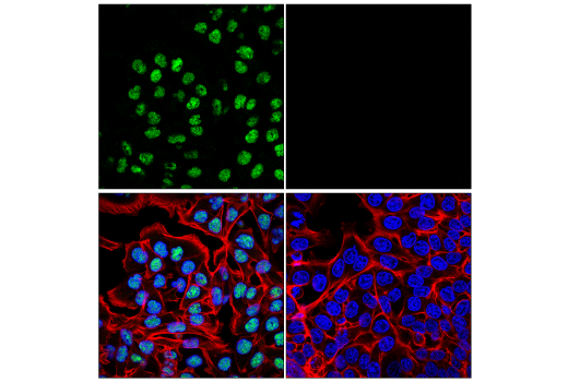 Immunofluorescence Image 1: ADAR1 (E6X9R) XP® Rabbit mAb (Alexa Fluor® 488 Conjugate)