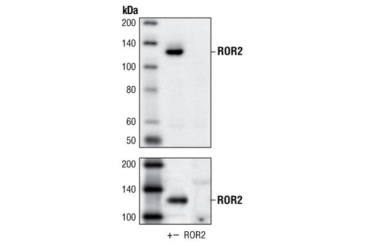 Western Blotting Image 1: ROR2 Antibody