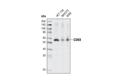 Western Blotting Image 1: CDK8 (P455) Antibody