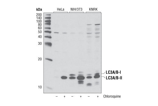 Western Blotting Image 1: LC3A/B Antibody