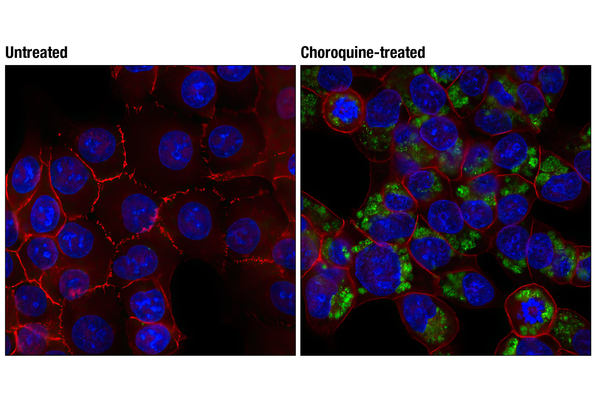 Immunofluorescence Image 1: LC3A/B Antibody