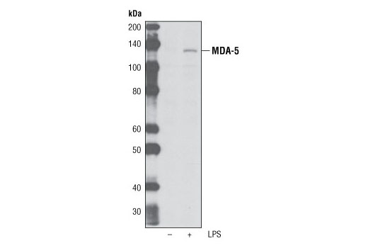 Western Blotting Image 1: MDA-5 (K375) Antibody