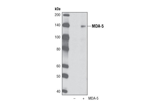 Western Blotting Image 2: MDA-5 (K375) Antibody