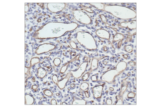 Immunohistochemistry Image 1: CD34 (ICO115) Mouse mAb (BSA and Azide Free)