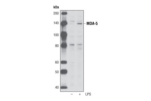 Western Blotting Image 1: MDA-5 (R470) Antibody