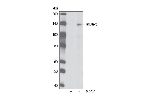 Western Blotting Image 2: MDA-5 (R470) Antibody