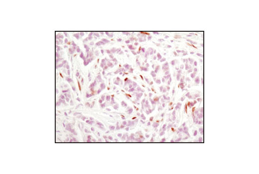 Immunohistochemistry Image 1: Phospho-Stat3 (Tyr705) (M9C6) Mouse mAb
