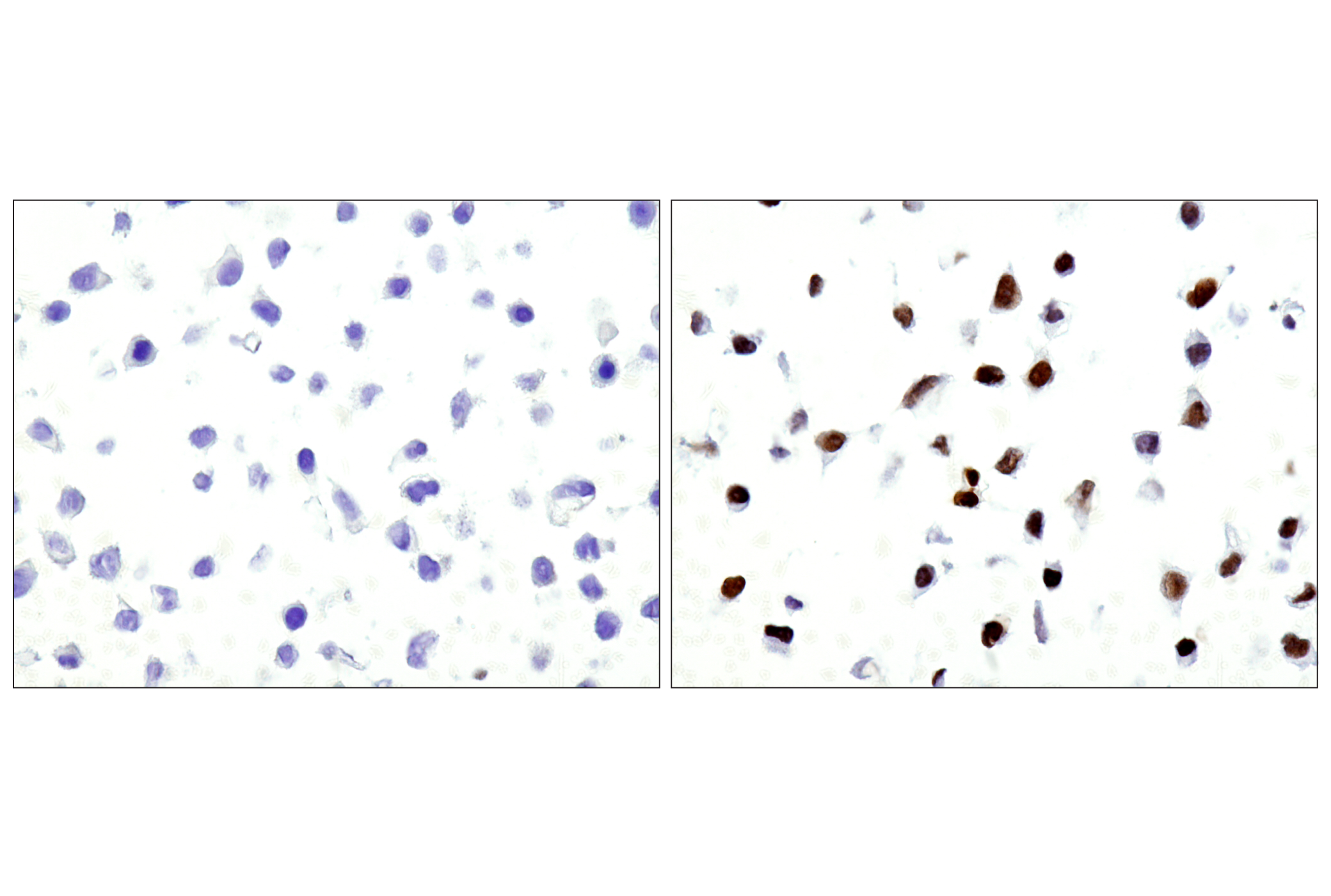 Immunohistochemistry Image 2: Phospho-Stat3 (Tyr705) (M9C6) Mouse mAb
