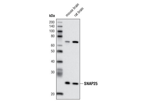 Western Blotting Image 1: SNAP25 (A195) Antibody