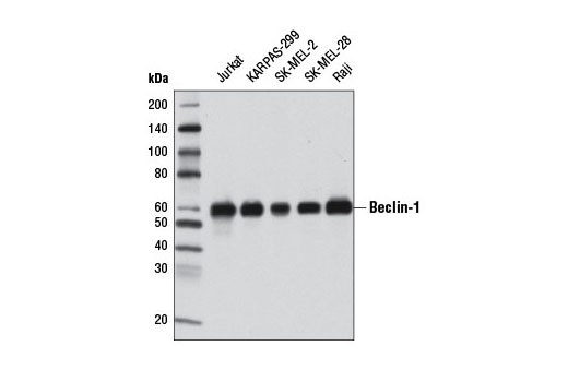 Western Blotting Image 1: Beclin-1 (2A4) Mouse mAb