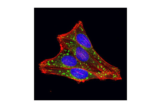 Immunofluorescence Image 1: Rab7 (D95F2) XP® Rabbit mAb (BSA and Azide Free)