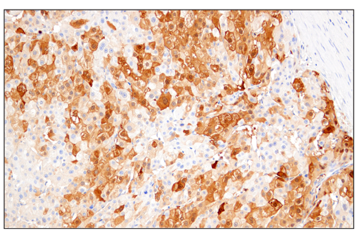 Immunohistochemistry Image 2: Arginase-1 (E4U1I) Mouse mAb (BSA and Azide Free)