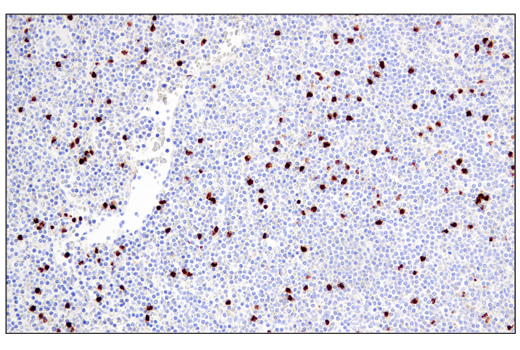 Immunohistochemistry Image 3: Arginase-1 (E4U1I) Mouse mAb (BSA and Azide Free)