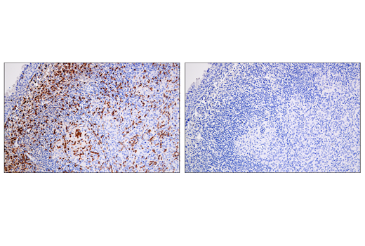 Immunohistochemistry Image 5: Arginase-1 (E4U1I) Mouse mAb (BSA and Azide Free)