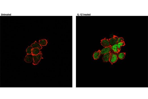 Immunofluorescence Image 1: Phospho-Stat4 (Tyr693) (D2E4) Rabbit mAb