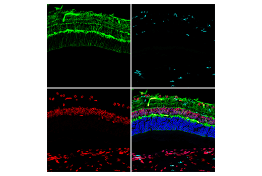Immunofluorescence Image 2: Lamin A/C (4C11) Mouse mAb (Alexa Fluor® 647 Conjugate)