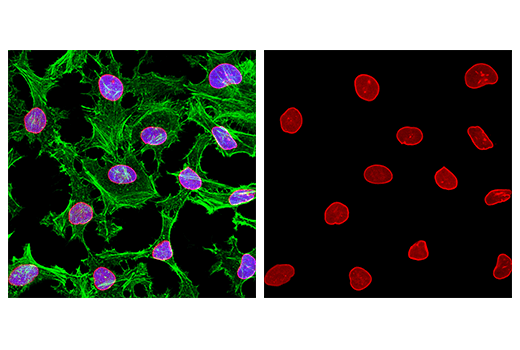 Immunofluorescence Image 3: Lamin A/C (4C11) Mouse mAb (Alexa Fluor® 647 Conjugate)